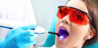 Understanding the Importance of Ongoing Dental Care Understanding the Importance of Ongoing Dental Care