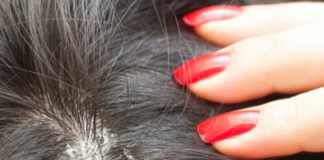 All You Need To Know About Super Lice Super Lice