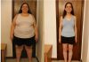 Trimming the Fat: Best Weight Loss Surgery in Turkey