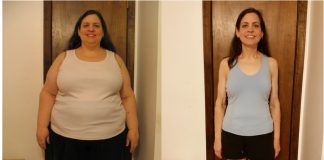 Trimming the Fat: Best Weight Loss Surgery in Turkey