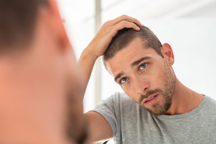 The Bald Truth: 5 Myths About Hair Loss