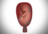 How To Test Amniotic Fluid Leak At Home: Prevention Is Better Than Cure how to test amniotic fluid leak at home