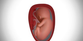 How To Test Amniotic Fluid Leak At Home: Prevention Is Better Than Cure how to test amniotic fluid leak at home